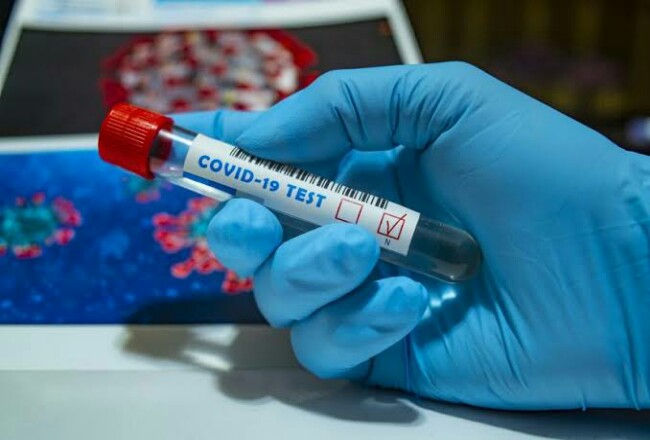 Sembuh dari Covid-19, Sabarudi Ingatkan Masyarakat Agar Tidak Acuh Protokol Kesehatan